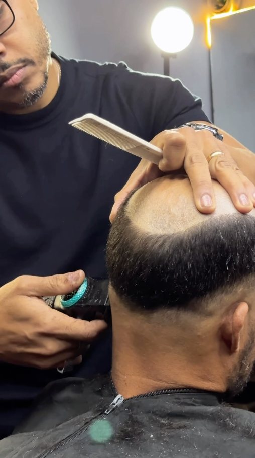 Clayton raspando a área calva de um cliente